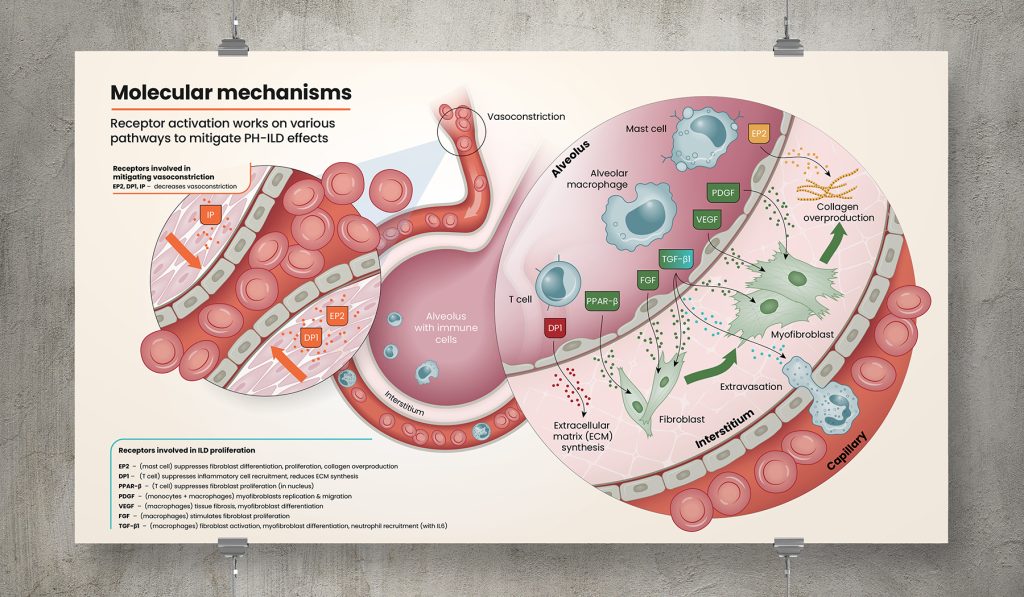 Life Science pathogenesis illustration for United Therapeutics GMA Division